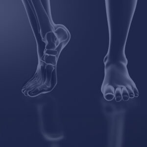 Minimally Invasive Surgery